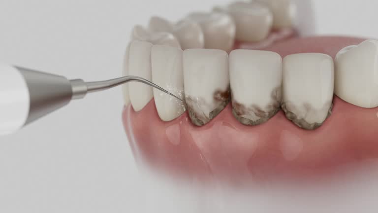 Trusted Teeth Whitening service in Baird, TX - Dentist Open Now